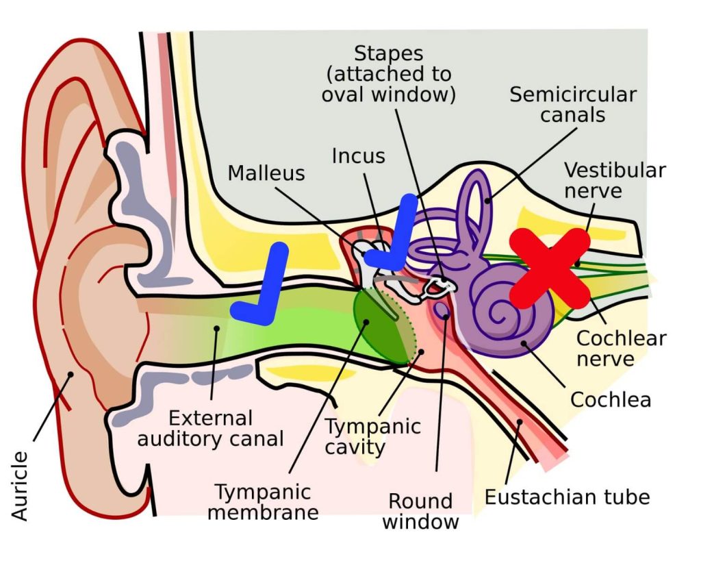 Hearing Loss in Singapore - Hearing Specialist & Audiologist in ...
